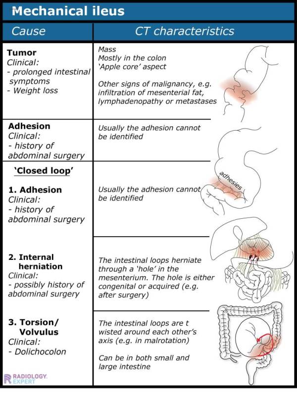 CT abdomen general